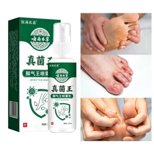 YKSJ Yunnan Herbal Anti Itch Antibacterial Foot Spray for Sweaty Feet & Peeling Relief Mild Non Irritating 60ml Herbal Fragrance